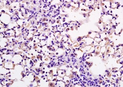 Phospho-DOK2 (Tyr351) Rabbit Polyclonal Antibody